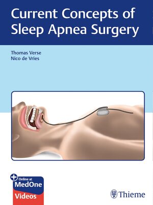 cover image of Current Concepts of Sleep Apnea Surgery